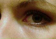 Фотография Щепаловой Анны